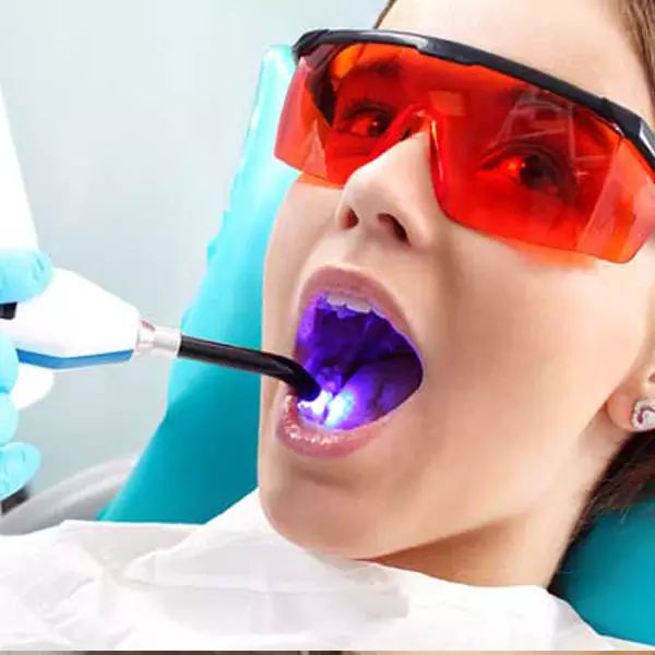 لیزر در دندانپزشکی